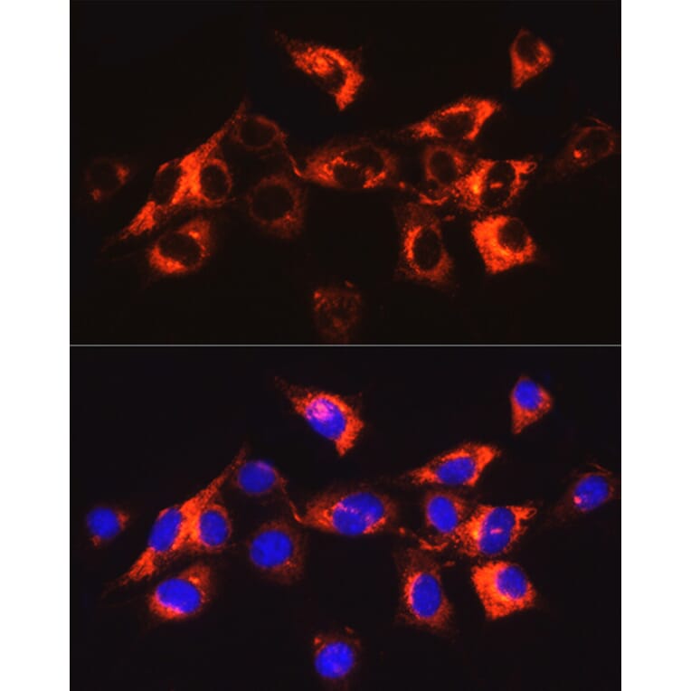 Immunofluorescence - Anti-Collagen I Antibody (A88196) - Antibodies.com