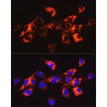 Immunofluorescence - Anti-Collagen I Antibody (A88196) - Antibodies.com