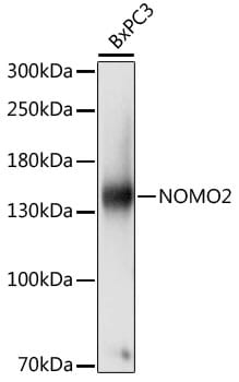 Western blot analysis of extracts of BxPC3 cells, using Anti-NOMO2 Antibody (A16614) at 1:1,000 dilution.
Secondary antibody: Goat Anti-Rabbit IgG (H+L) (HRP) (AS014) at 1:10,000 dilution.
Lysates / proteins: 25µg per lane.
Blocking buffer: 3% non-fat dry milk in TBST.
Detection: ECL Basic Kit (RM00020).
Exposure time: 1s.