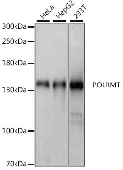 Western blot analysis of extracts of various cell lines, using Anti-POLRMT Antibody (A15605) at 1:1,000 dilution.
Secondary antibody: Goat Anti-Rabbit IgG (H+L) (HRP) (AS014) at 1:10,000 dilution.
Lysates / proteins: 25µg per lane.
Blocking buffer: 3% non-fat dry milk in TBST.
Detection: ECL Basic Kit (RM00020).
Exposure time: 1s.