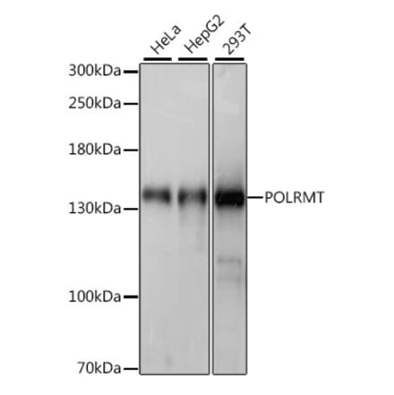 Western Blot - Anti-POLRMT Antibody (A88198) - Antibodies.com