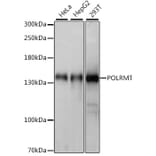 Western Blot - Anti-POLRMT Antibody (A88198) - Antibodies.com