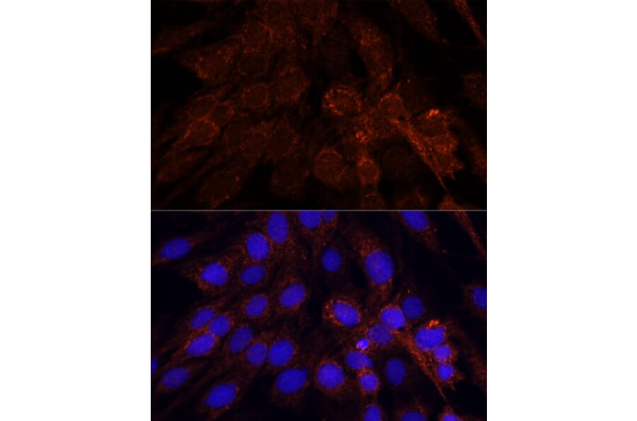 Immunofluorescence - Anti-POLRMT Antibody (A88198) - Antibodies.com