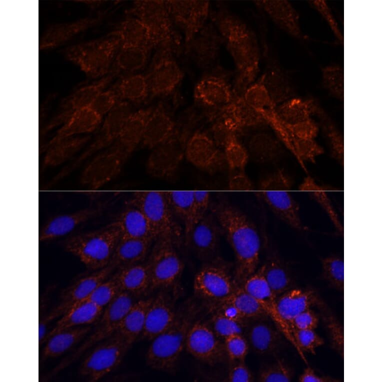 Immunofluorescence - Anti-POLRMT Antibody (A88198) - Antibodies.com