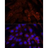 Immunofluorescence - Anti-POLRMT Antibody (A88198) - Antibodies.com