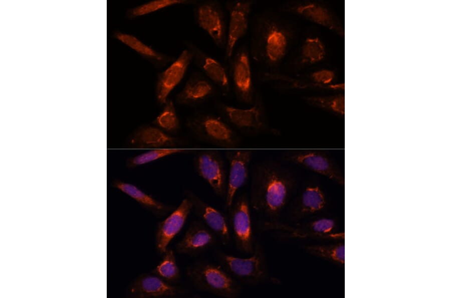 Immunofluorescence - Anti-POLRMT Antibody (A88198) - Antibodies.com