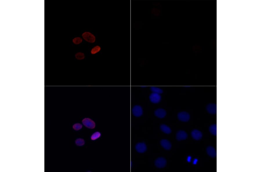 Immunofluorescence - Anti-Histone H4 (acetyl Lys16) Antibody (A88199) - Antibodies.com
