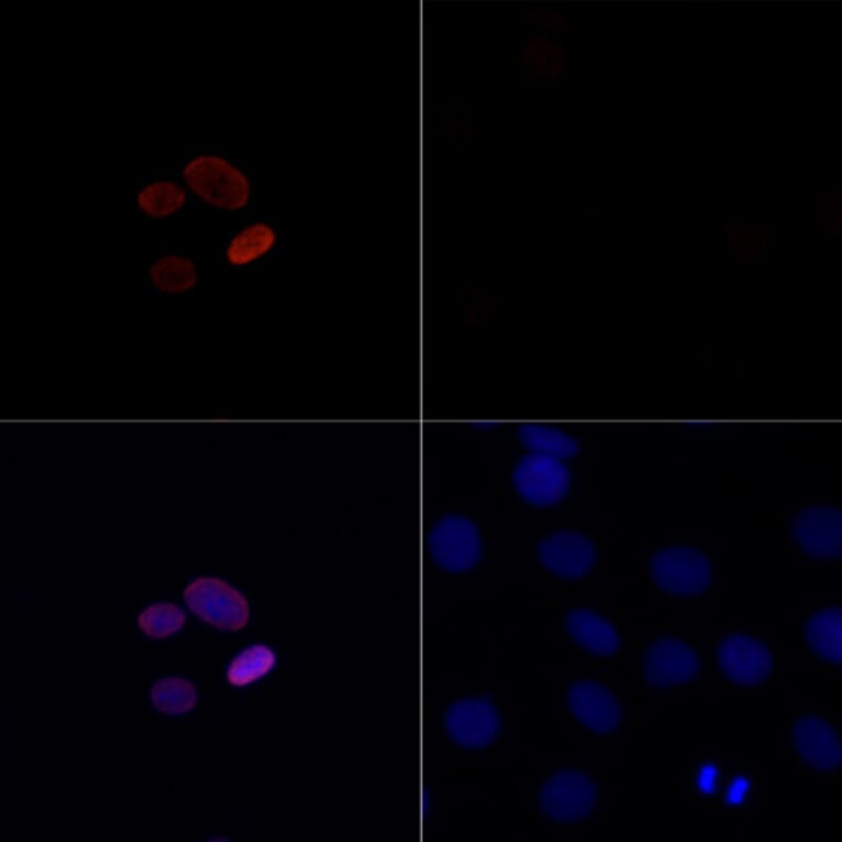 Immunofluorescence - Anti-Histone H4 (acetyl Lys16) Antibody (A88199) - Antibodies.com