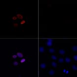 Immunofluorescence - Anti-Histone H4 (acetyl Lys16) Antibody (A88199) - Antibodies.com