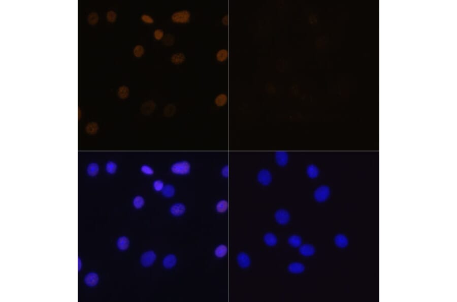 Immunofluorescence - Anti-Histone H4 (acetyl Lys16) Antibody (A88199) - Antibodies.com