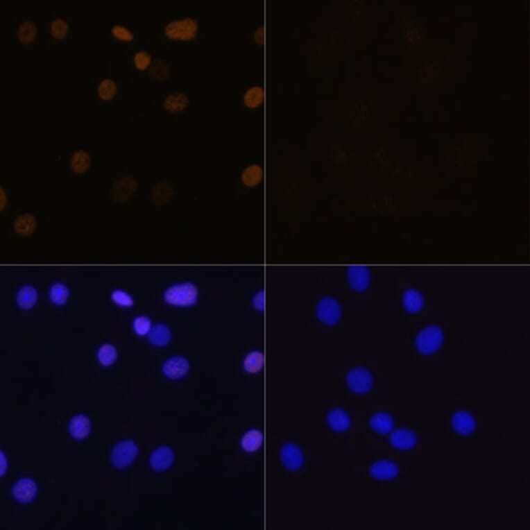 Immunofluorescence - Anti-Histone H4 (acetyl Lys16) Antibody (A88199) - Antibodies.com