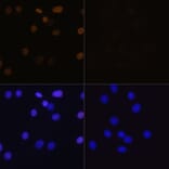 Immunofluorescence - Anti-Histone H4 (acetyl Lys16) Antibody (A88199) - Antibodies.com