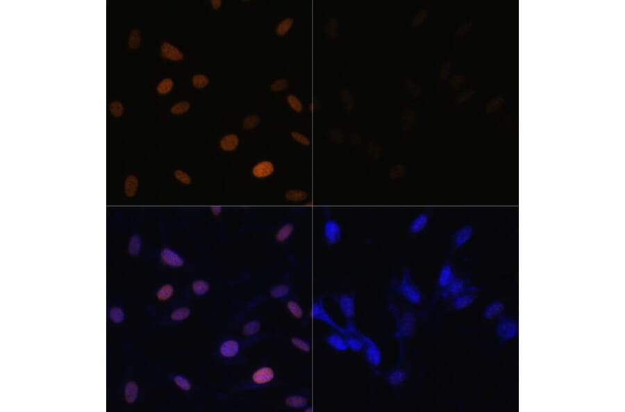 Immunofluorescence - Anti-Histone H4 (acetyl Lys16) Antibody (A88199) - Antibodies.com