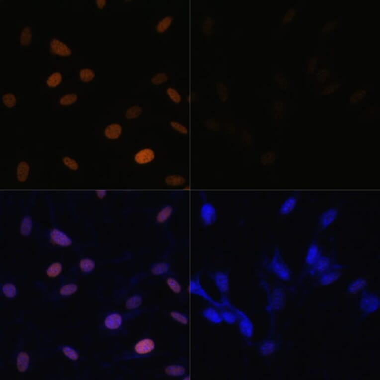 Immunofluorescence - Anti-Histone H4 (acetyl Lys16) Antibody (A88199) - Antibodies.com