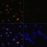Immunofluorescence - Anti-Histone H4 (acetyl Lys16) Antibody (A88199) - Antibodies.com