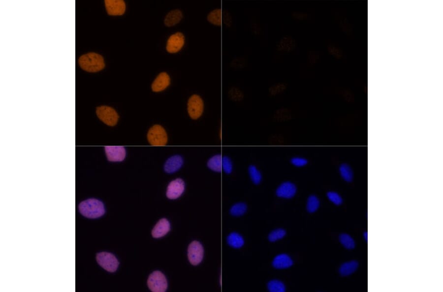 Immunofluorescence - Anti-Histone H4 (acetyl Lys16) Antibody (A88199) - Antibodies.com