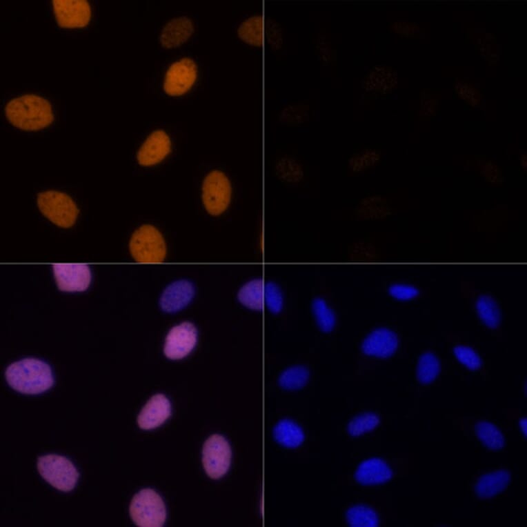 Immunofluorescence - Anti-Histone H4 (acetyl Lys16) Antibody (A88199) - Antibodies.com