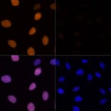Immunofluorescence - Anti-Histone H4 (acetyl Lys16) Antibody (A88199) - Antibodies.com
