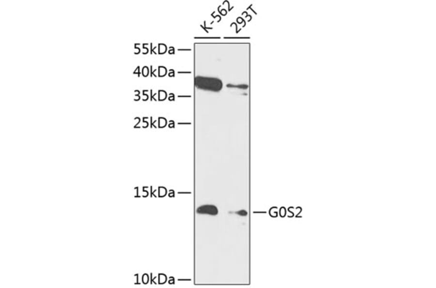 Western Blot - Anti-G0/G1switch 2/G0S2 Antibody (A88201) - Antibodies.com