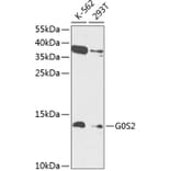 Western Blot - Anti-G0/G1switch 2/G0S2 Antibody (A88201) - Antibodies.com