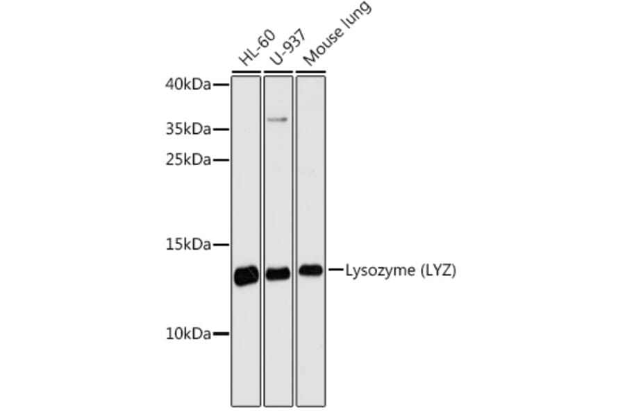 Western Blot - Anti-Lysozyme Antibody (A88202) - Antibodies.com