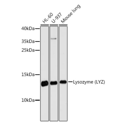 Western Blot - Anti-Lysozyme Antibody (A88202) - Antibodies.com