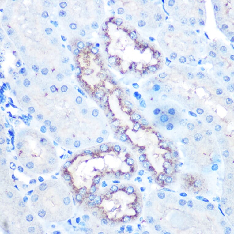 Immunohistochemistry - Anti-Lysozyme Antibody (A88202) - Antibodies.com