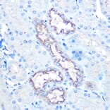 Immunohistochemistry - Anti-Lysozyme Antibody (A88202) - Antibodies.com