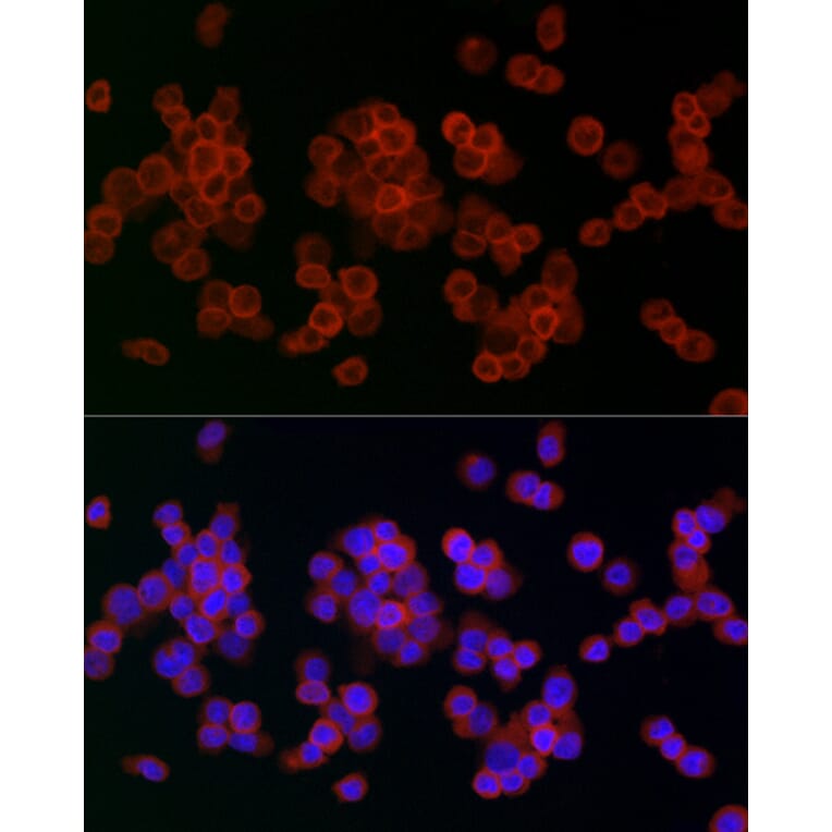 Immunofluorescence - Anti-Lysozyme Antibody (A88202) - Antibodies.com