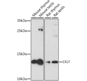 Western Blot - Anti-CKLF Antibody (A88203) - Antibodies.com
