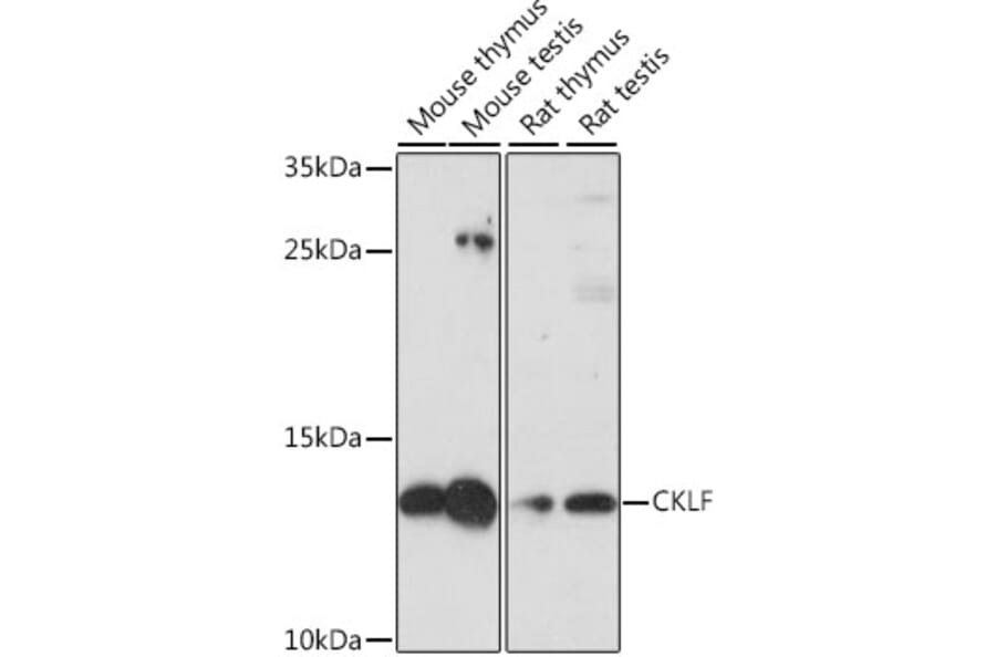 Western Blot - Anti-CKLF Antibody (A88203) - Antibodies.com