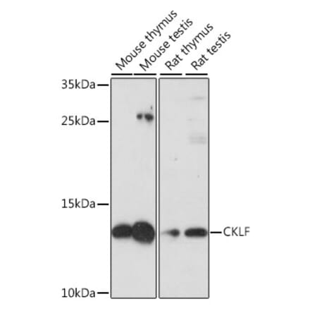 Western Blot - Anti-CKLF Antibody (A88203) - Antibodies.com