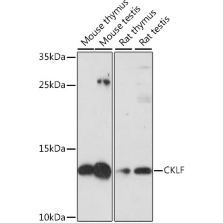 Western Blot - Anti-CKLF Antibody (A88203) - Antibodies.com