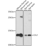 Western Blot - Anti-CKLF Antibody (A88203) - Antibodies.com