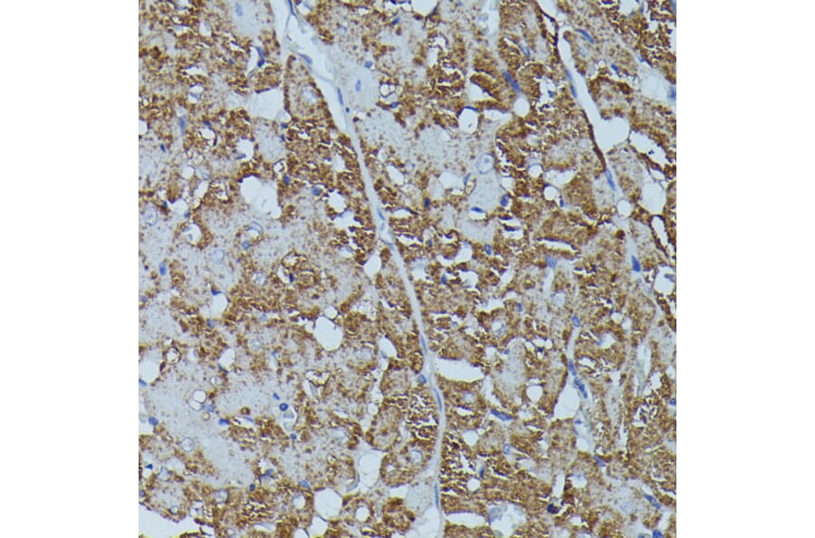 Immunohistochemistry - Anti-Calstabin-2 Antibody (A88204) - Antibodies.com
