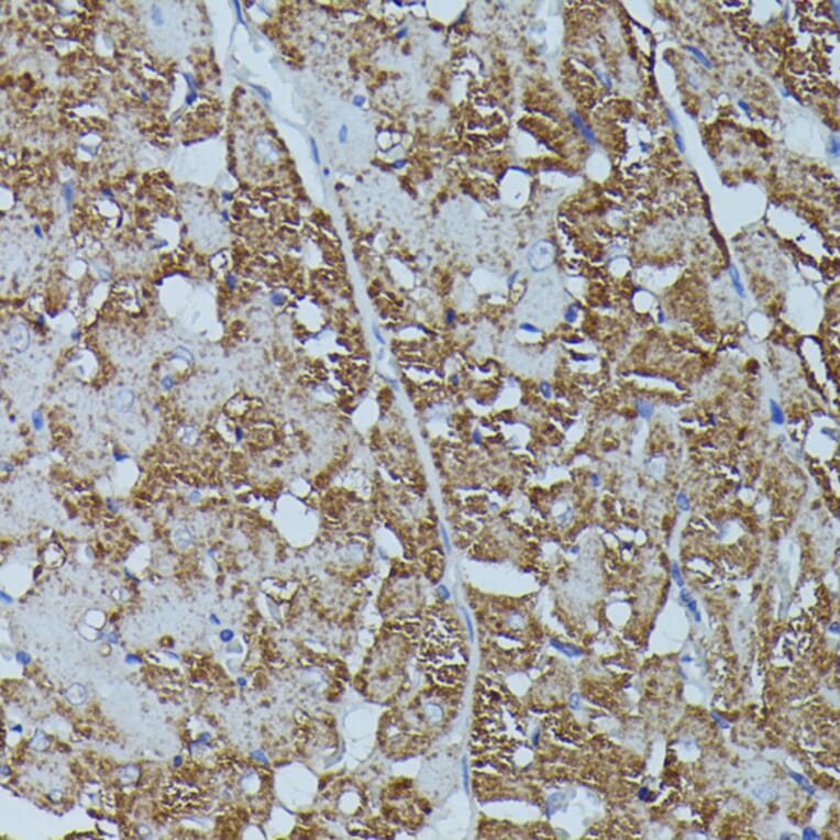Immunohistochemistry - Anti-Calstabin-2 Antibody (A88204) - Antibodies.com