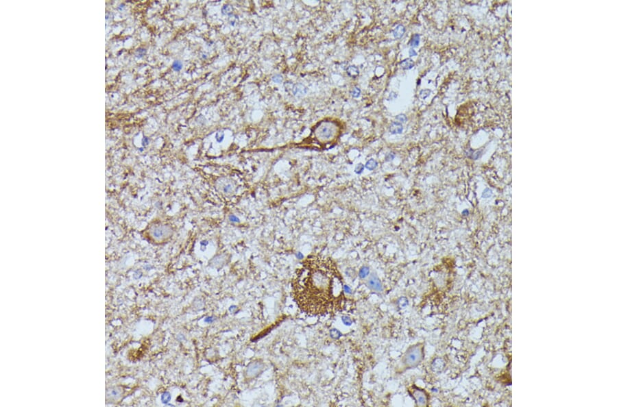 Immunohistochemistry - Anti-Calstabin-2 Antibody (A88204) - Antibodies.com