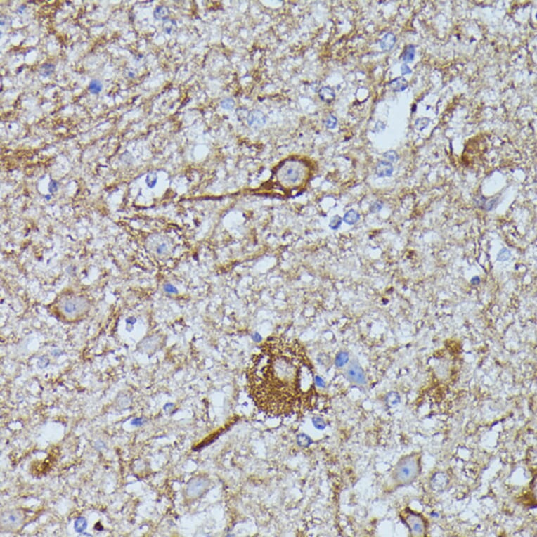 Immunohistochemistry - Anti-Calstabin-2 Antibody (A88204) - Antibodies.com