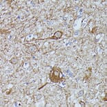 Immunohistochemistry - Anti-Calstabin-2 Antibody (A88204) - Antibodies.com