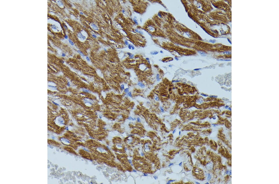 Immunohistochemistry - Anti-Calstabin-2 Antibody (A88204) - Antibodies.com