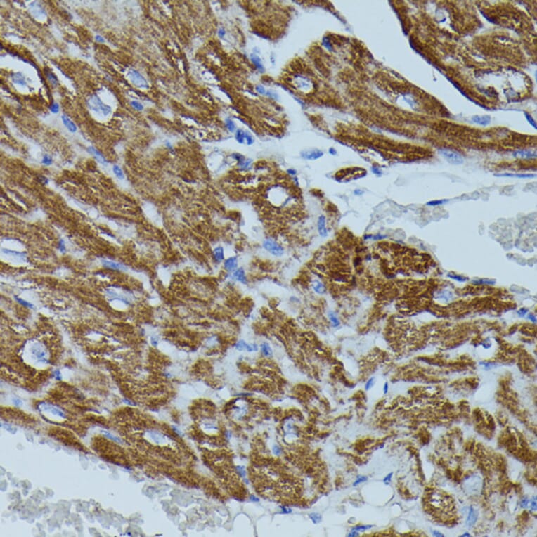 Immunohistochemistry - Anti-Calstabin-2 Antibody (A88204) - Antibodies.com