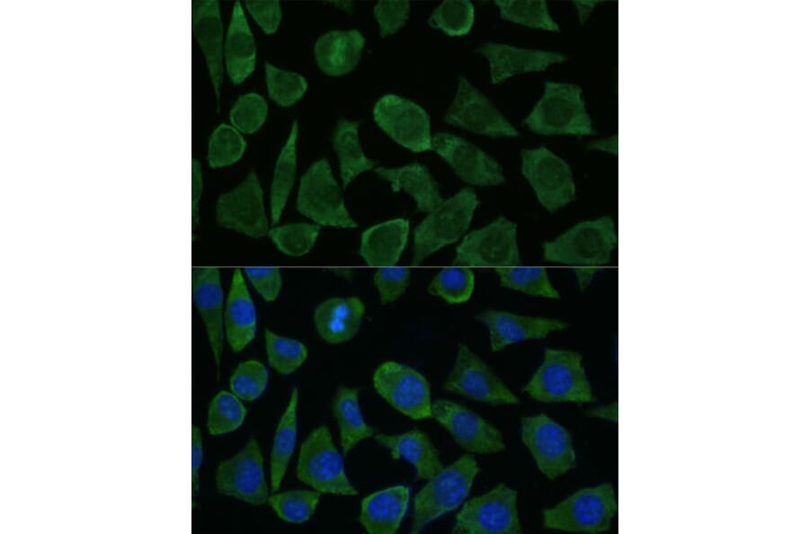 Immunofluorescence - Anti-Calstabin-2 Antibody (A88204) - Antibodies.com
