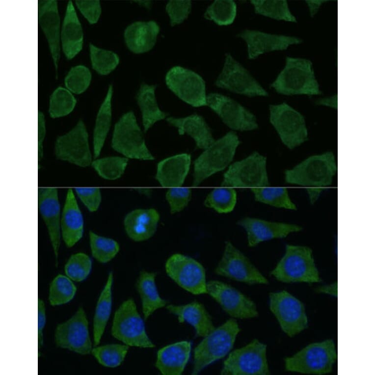 Immunofluorescence - Anti-Calstabin-2 Antibody (A88204) - Antibodies.com