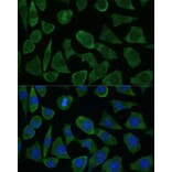 Immunofluorescence - Anti-Calstabin-2 Antibody (A88204) - Antibodies.com