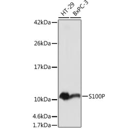 Western Blot - Anti-S100P Antibody (A88205) - Antibodies.com