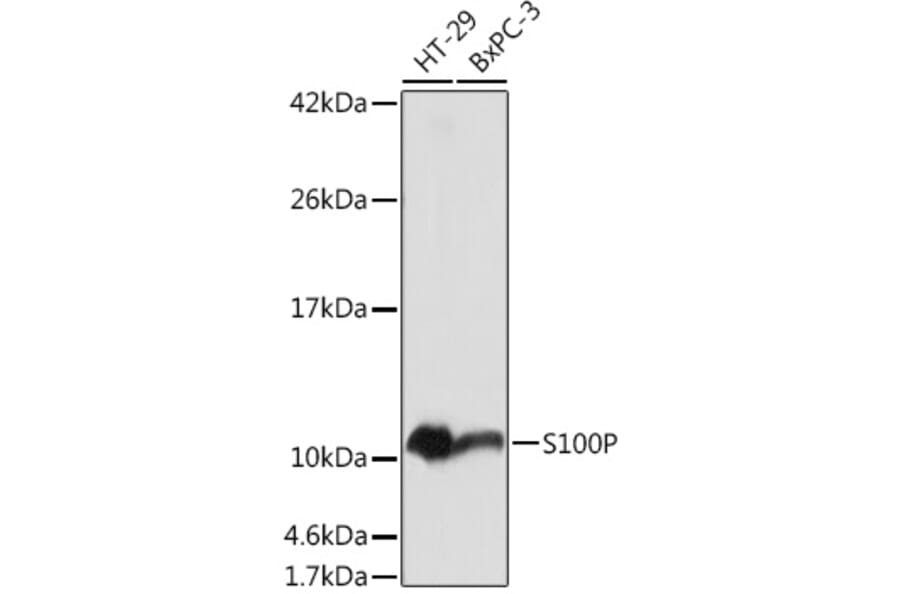 Western Blot - Anti-S100P Antibody (A88205) - Antibodies.com