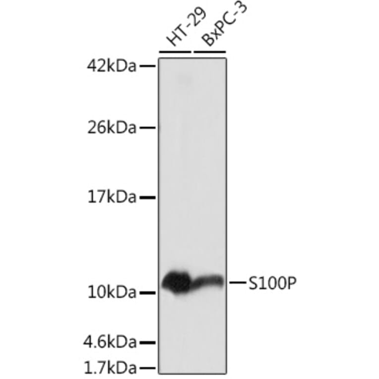 Western Blot - Anti-S100P Antibody (A88205) - Antibodies.com