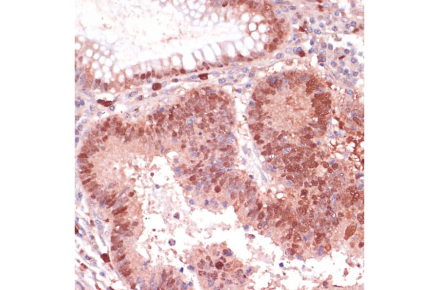 Immunohistochemistry - Anti-S100P Antibody (A88205) - Antibodies.com