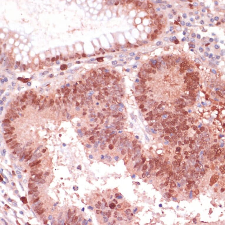 Immunohistochemistry - Anti-S100P Antibody (A88205) - Antibodies.com