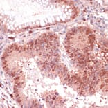 Immunohistochemistry - Anti-S100P Antibody (A88205) - Antibodies.com